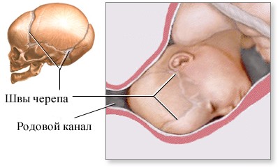 Правильная форма черепа новорожденного
